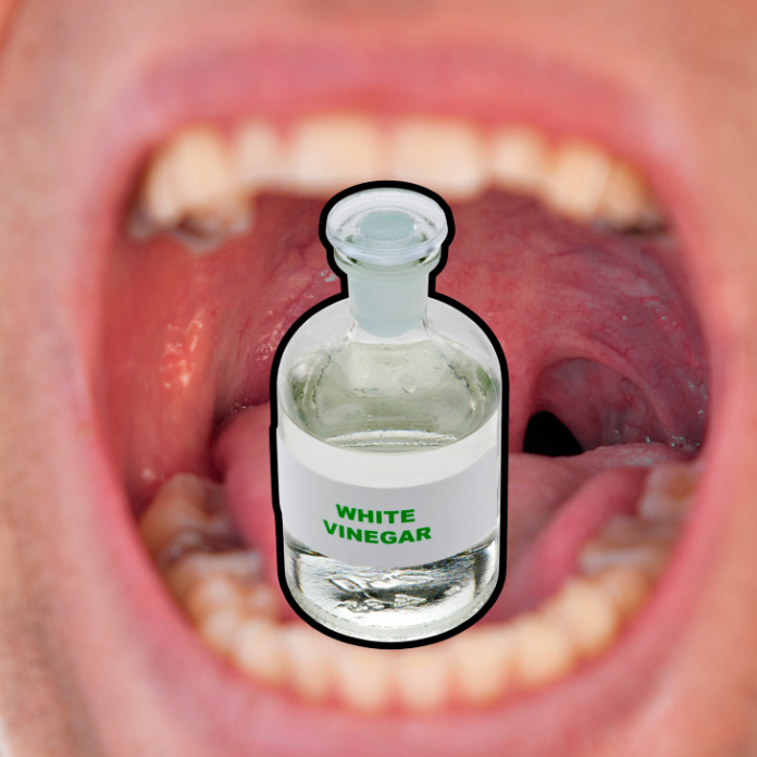 using-white-vinegar-for-sore-throat-relief-ultimate-guide